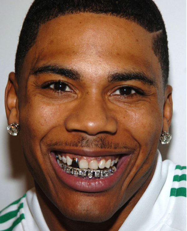 The History of Grillz